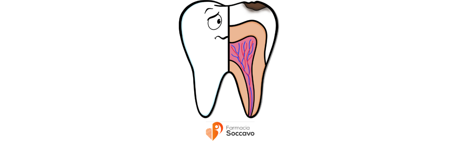 Come prevenire le carie dentali