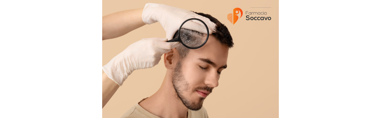 Forfora e Cute Sensibile: Cause, Sintomi e i Migliori Trattamenti per il Cuoio Capelluto