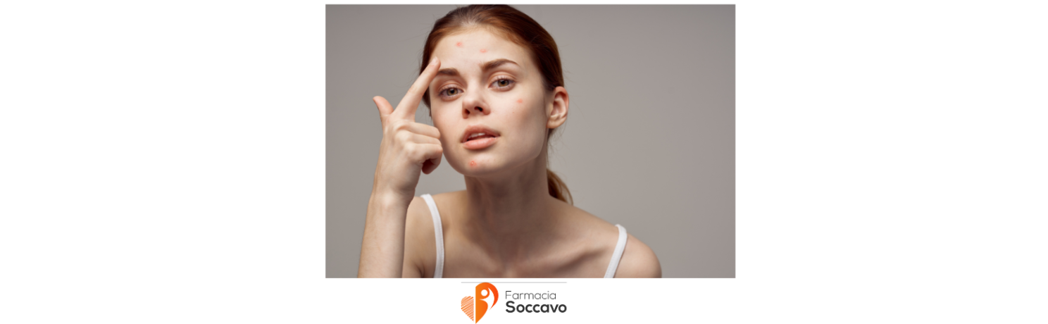 Problemi alla pelle: che prodotti usare?