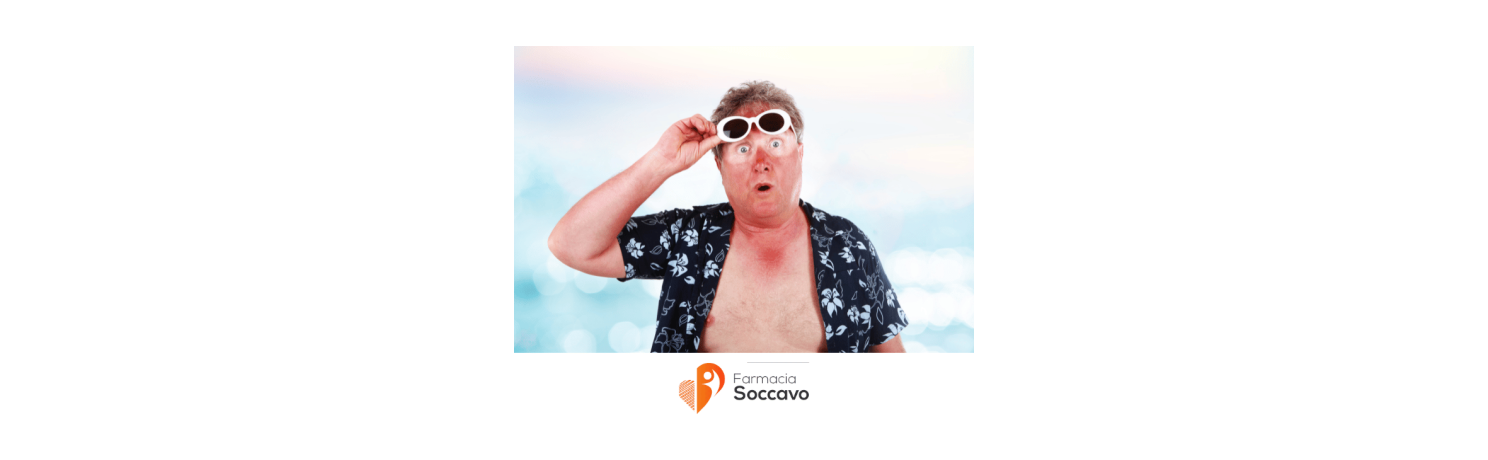 Scottature da Sole: Rimedi Naturali Efficaci per Alleviare il Dolore e Rigenerare la Pelle
