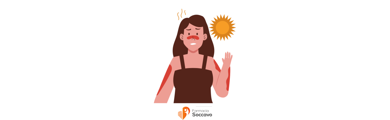 Scottature Solari: Rimedi, Trattamenti e Prevenzione Efficace