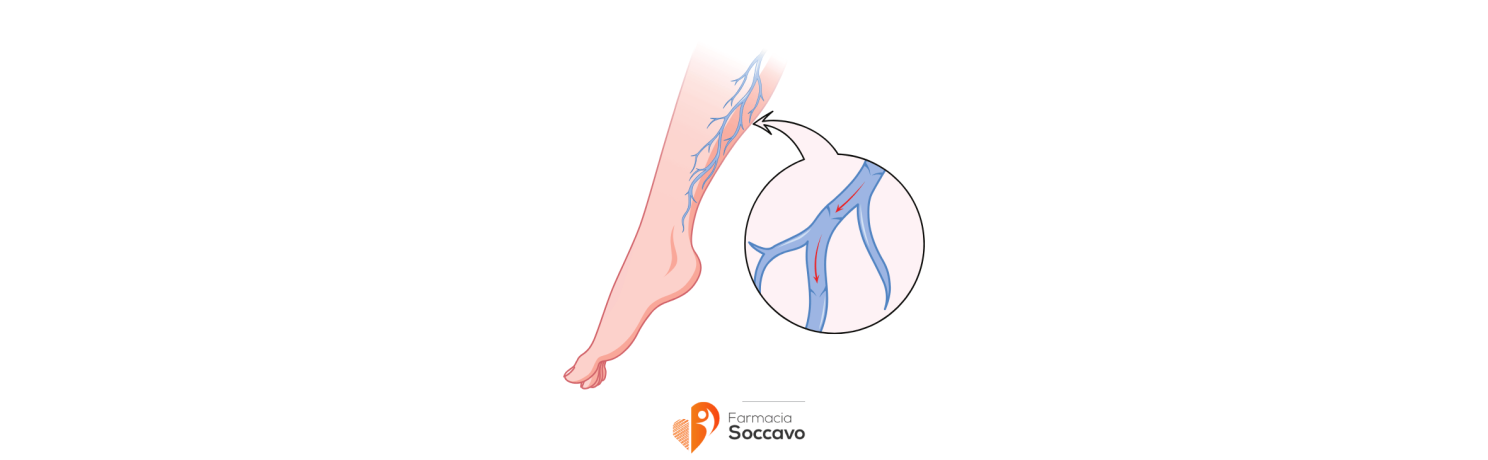Creme per le Vene: Guida Completa per il Benessere delle Gambe