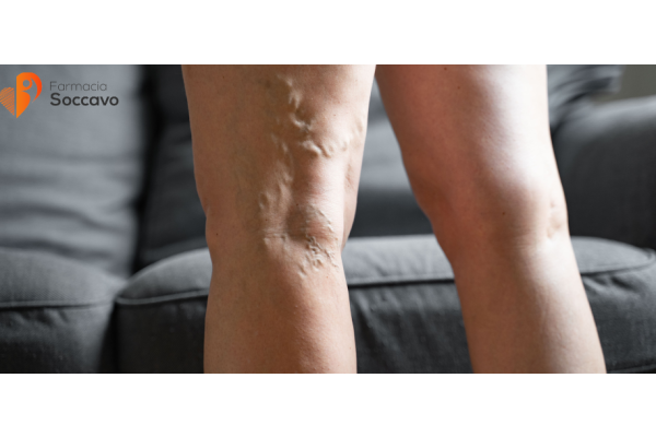 Gambe Gonfie e Pesanti in Estate: Rimedi Naturali e Integratori per la Circolazione