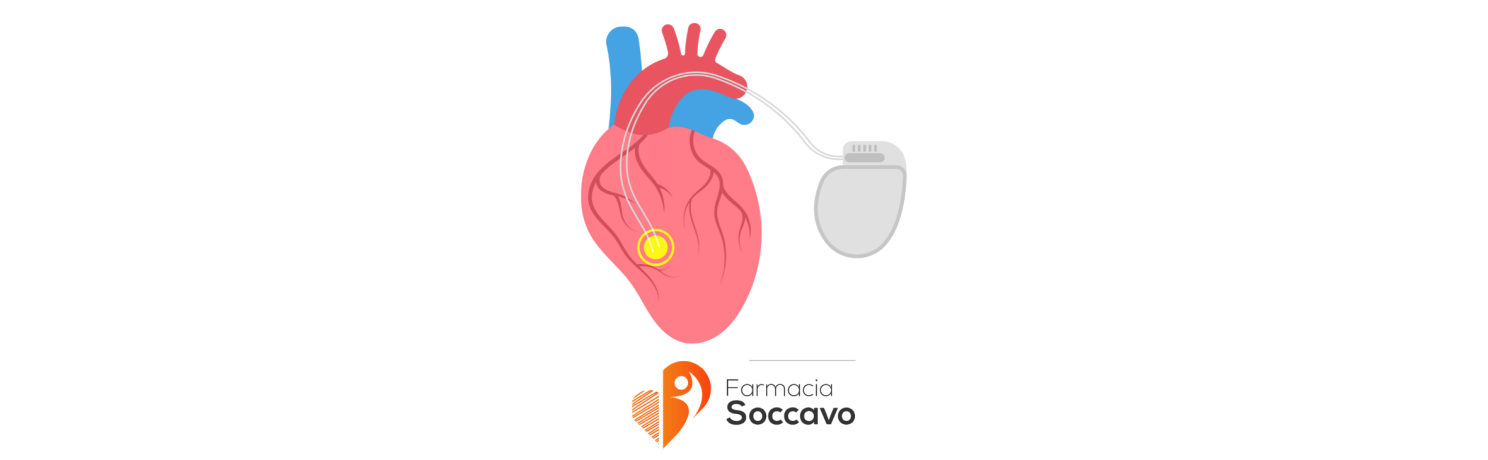 Holter Cardiaco - ECG a Napoli: Scopri le Differenze e Prenota il Tuo Esame Gratuito su FarmaciaSoccavo.it
