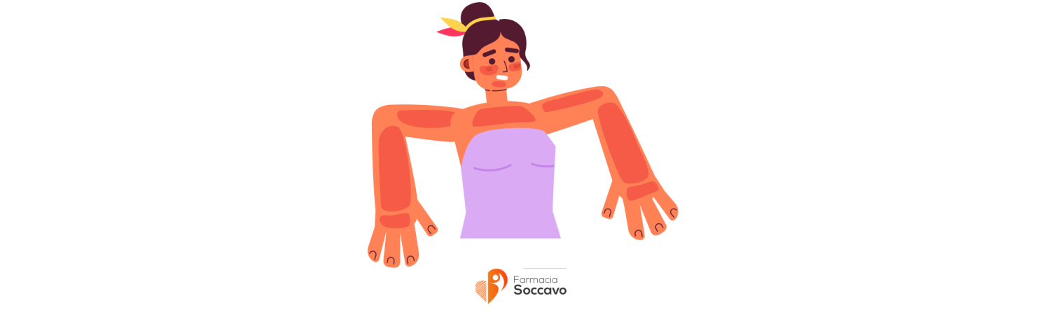 Le Migliori Creme per Scottature Solari del 2024: Guida Completa su Farmaciasoccavo.it
