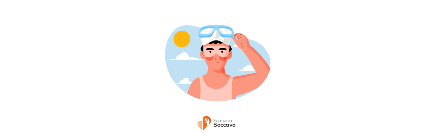 Rimedi per le Scottature Solari: Guida Completa per il Sollievo e la Guarigione