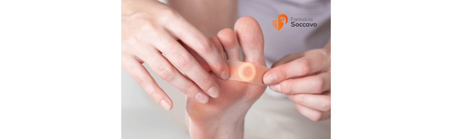 Verruche, Calli e Duroni: Cause, Differenze e Trattamenti