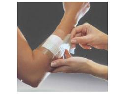 Opsite Flexifix Cm10X10Mt 1 Pezzo