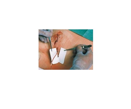 Medicazione per tubi di drenaggio fessurata metalline drain 6x7cm foro 4,5x11mm 50 pezzi