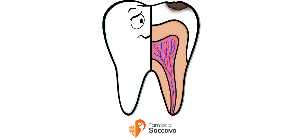 Come prevenire le carie dentali